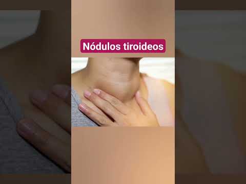NÓDULOS TIROIDEOS BULTOS EN EL CUELLO